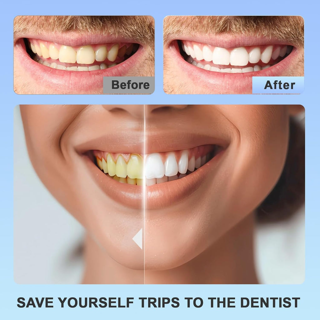 Teeth Whitening Strips 14 Kit - For Teeth Whitening , Deep Stains Removal, Carefully Designed Whitening Strips, Allowing You To Have a Brighter Smile(28 Pcs)